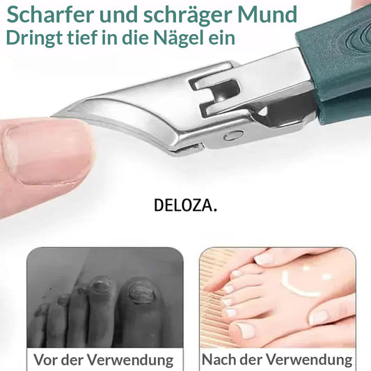ClipNail™-3-teiliges Nagelpflege-Set für eingewachsene Nägel [50% Rabatt]