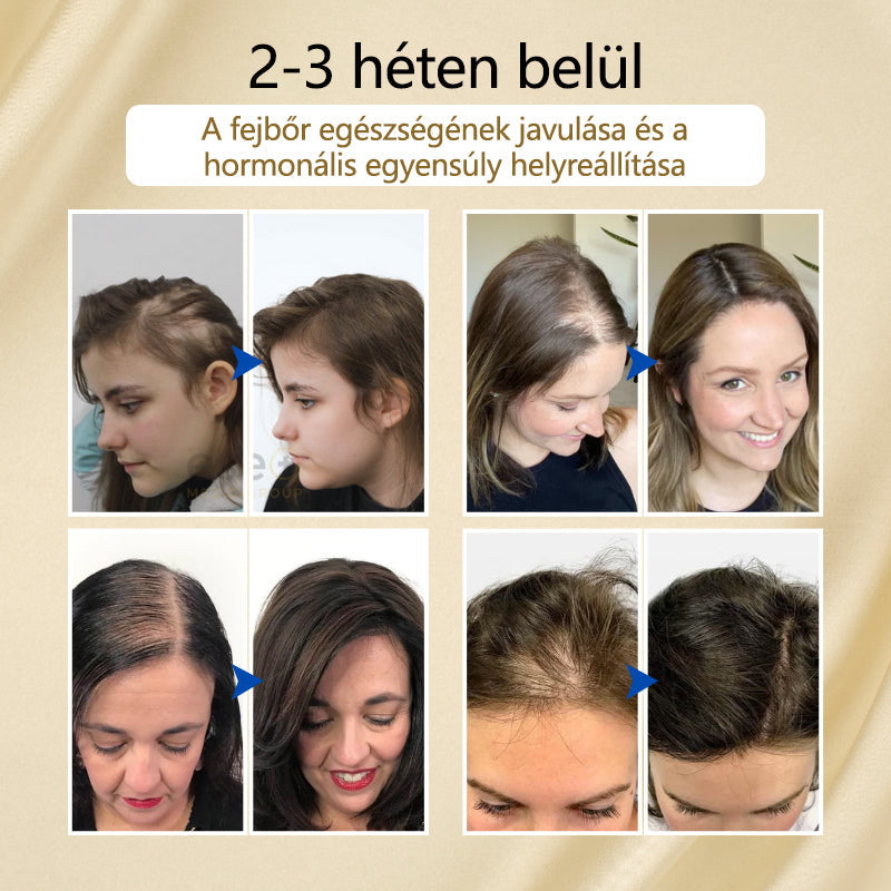 Timilk™ – VitaStrand Biotin Spray für gepflegtes, voller erscheinendes und strahlend glänzendes Haar [1 + 1 Gratis]