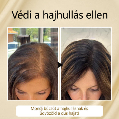 Timilk™ – VitaStrand Biotin Spray für gepflegtes, voller erscheinendes und strahlend glänzendes Haar [1 + 1 Gratis]