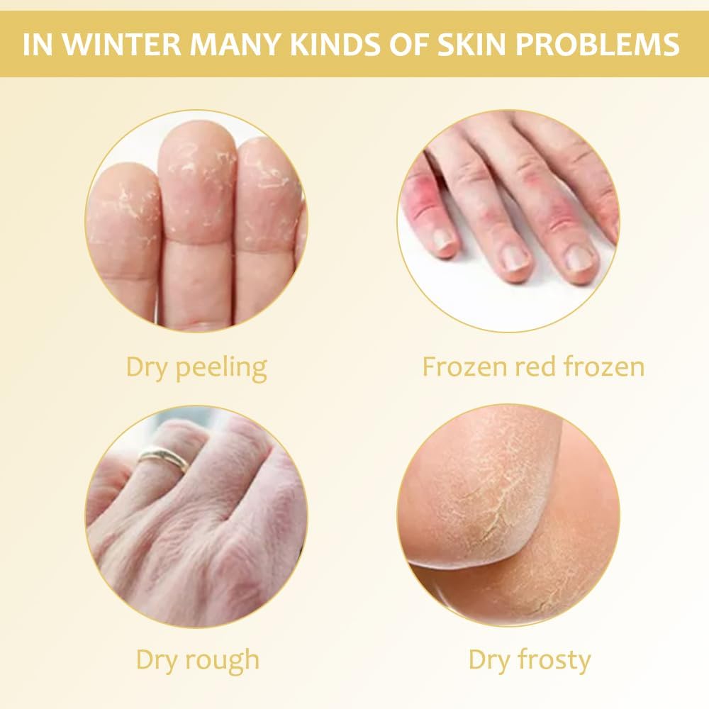 SkinShiner™ – Nährende Pflege für trockene Haut für sichtbar weichere, gepflegt aussehende Haut [1 + 1 Gratis]