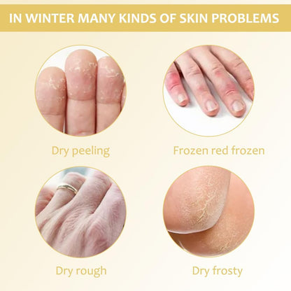 SkinShiner™ – Nährende Pflege für trockene Haut für sichtbar weichere, gepflegt aussehende Haut [1 + 1 Gratis]