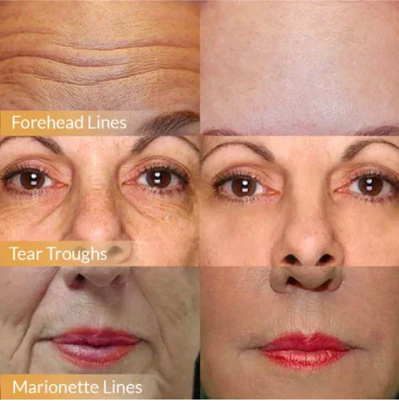 AgeCream™ – Pflegende Straffungscreme mit Ginseng & Granatapfel für ein glatter wirkendes Hautbild [1 + 1 Gratis]