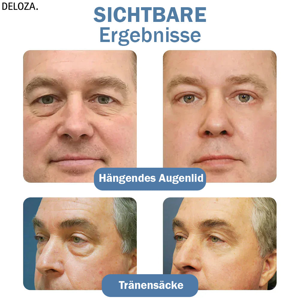 EyeRenew™ – Strahlende & jugendlich frische Augen-Erneuerung [50 % Rabatt]