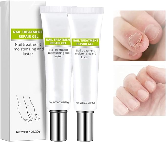 RejuveNail™ – Nährende Nagelpflege für natürlich kräftiger und schöner wirkende Nägel [1 + 1 Gratis]