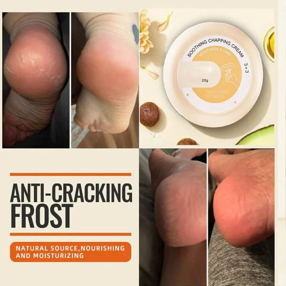 SkinShiner™ – Nährende Pflege für trockene Haut für sichtbar weichere, gepflegt aussehende Haut [1 + 1 Gratis]