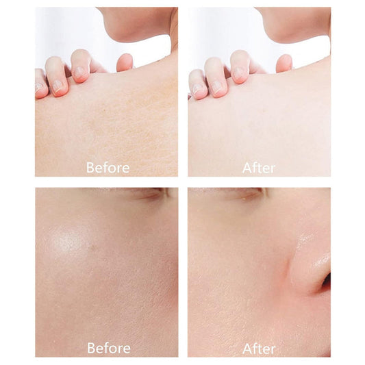 Derol™ – Verleiht der Haut einen natürlich strahlenden, jugendlich frischen Glow [1 + 1 Gratis]