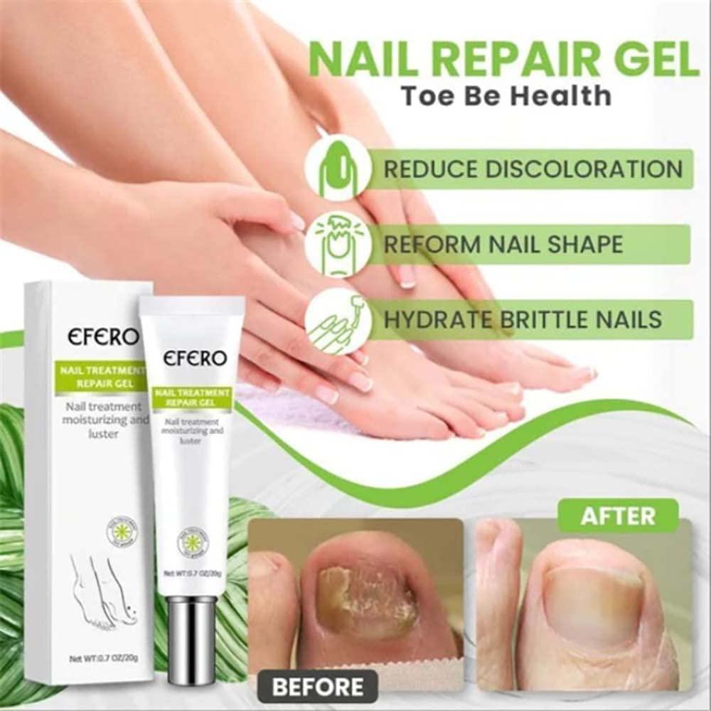 RejuveNail™ – Nährende Nagelpflege für natürlich kräftiger und schöner wirkende Nägel [1 + 1 Gratis]