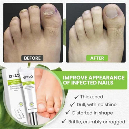 RejuveNail™ – Nährende Nagelpflege für natürlich kräftiger und schöner wirkende Nägel [1 + 1 Gratis]