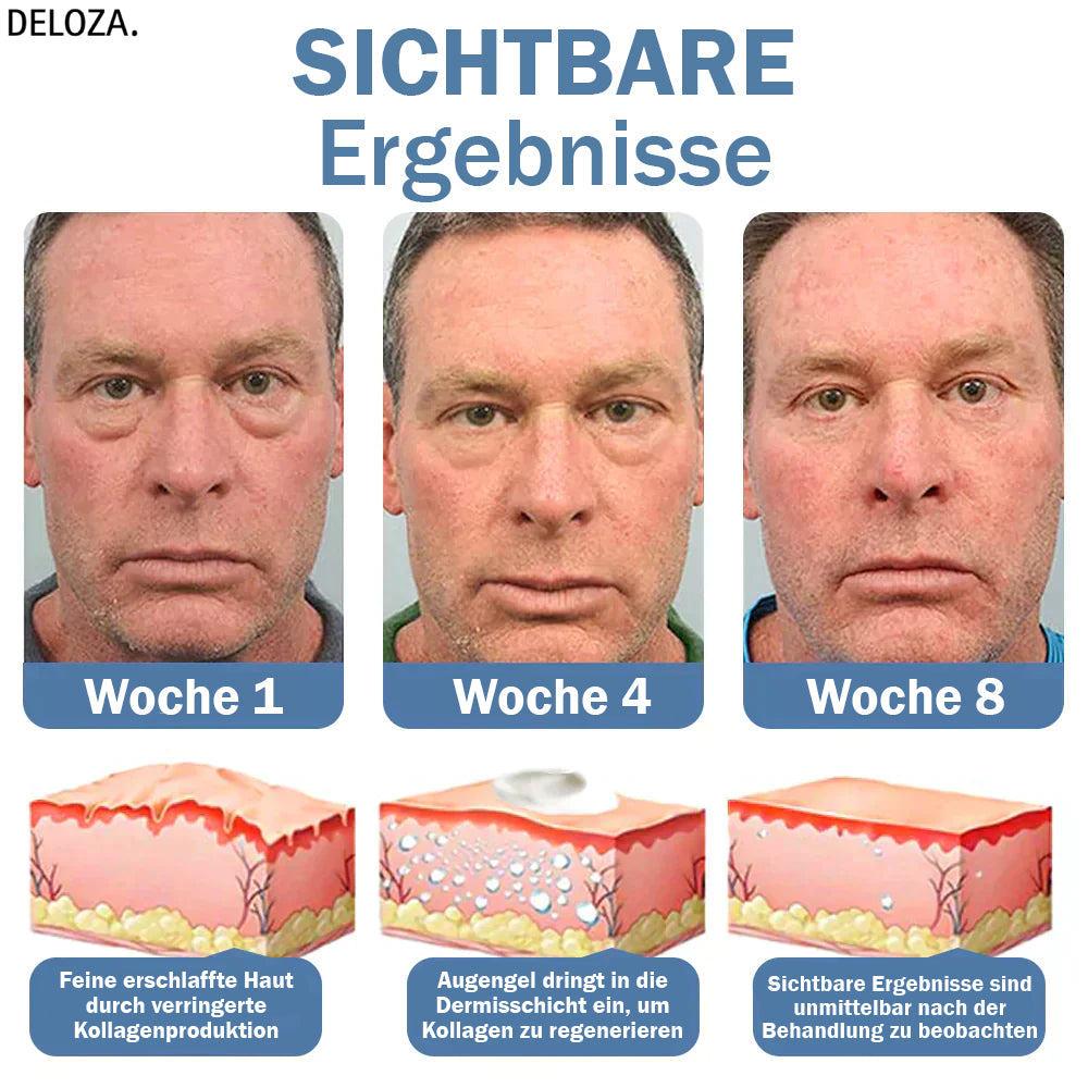 EyeRenew™ – Strahlende & jugendlich frische Augen-Erneuerung [50 % Rabatt]