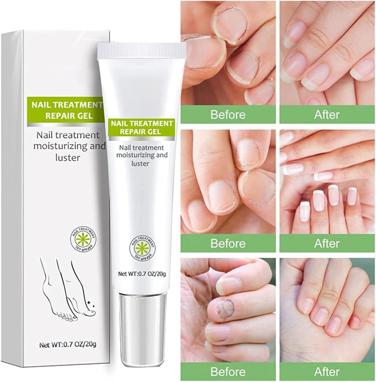 RejuveNail™ – Nährende Nagelpflege für natürlich kräftiger und schöner wirkende Nägel [1 + 1 Gratis]