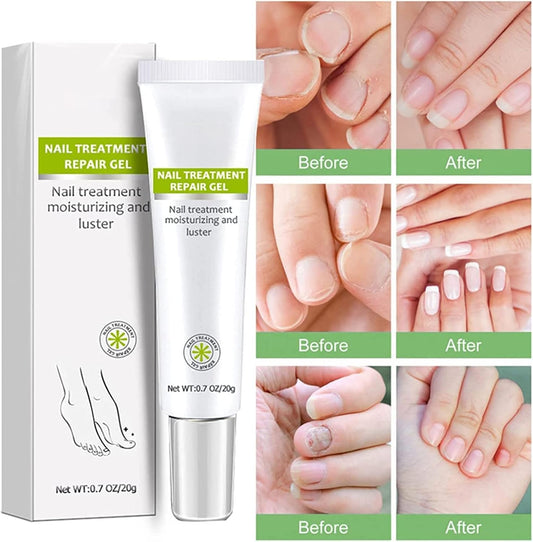 RejuveNail™ – Nährende Nagelpflege für natürlich kräftiger und schöner wirkende Nägel [1 + 1 Gratis]