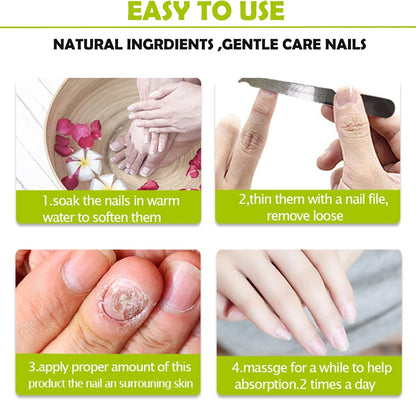 RejuveNail™ – Nährende Nagelpflege für natürlich kräftiger und schöner wirkende Nägel [1 + 1 Gratis]