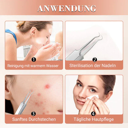 ClearSkin™ – Präzise Mitesserentfernung für glatte, reine & strahlende Haut [50% Rabatt]