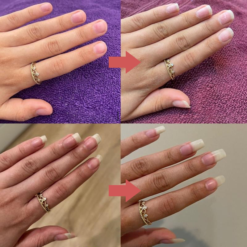 NailGrowth™ – Nährende, stärkende Nagelpflege mit Vitamin E & Biotin, 5 g [50% Rabatt]