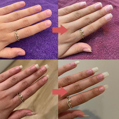 NailGrowth™ – Nährende, stärkende Nagelpflege mit Vitamin E & Biotin, 5 g [50% Rabatt]