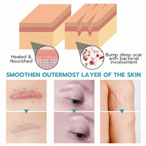 NuSkin™ – Silikon-Faltenpads für Stirn, Augen- und Lachlinien mit glättendem Effekt [50% Rabatt]