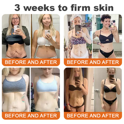 TLopa™ – Strafft die Haut und reduziert Falten mit Hyaluron & Peptiden für Gesicht und Körper [1 + 1 Gratis]