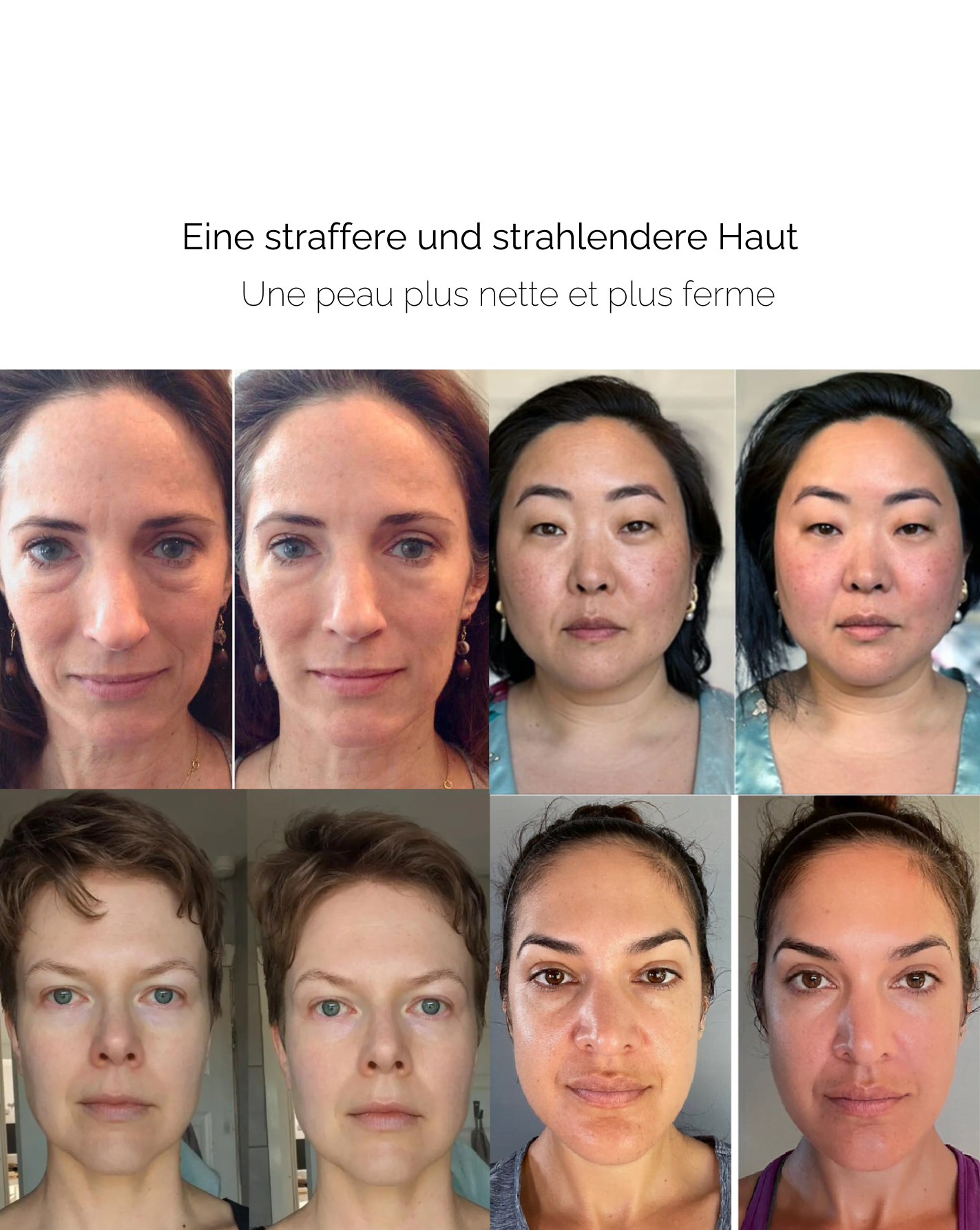 SkinRoll™ – Anti-Falten-Schönheitstool für glattere, strahlendere und jugendlich wirkende Haut [50 % Rabatt]