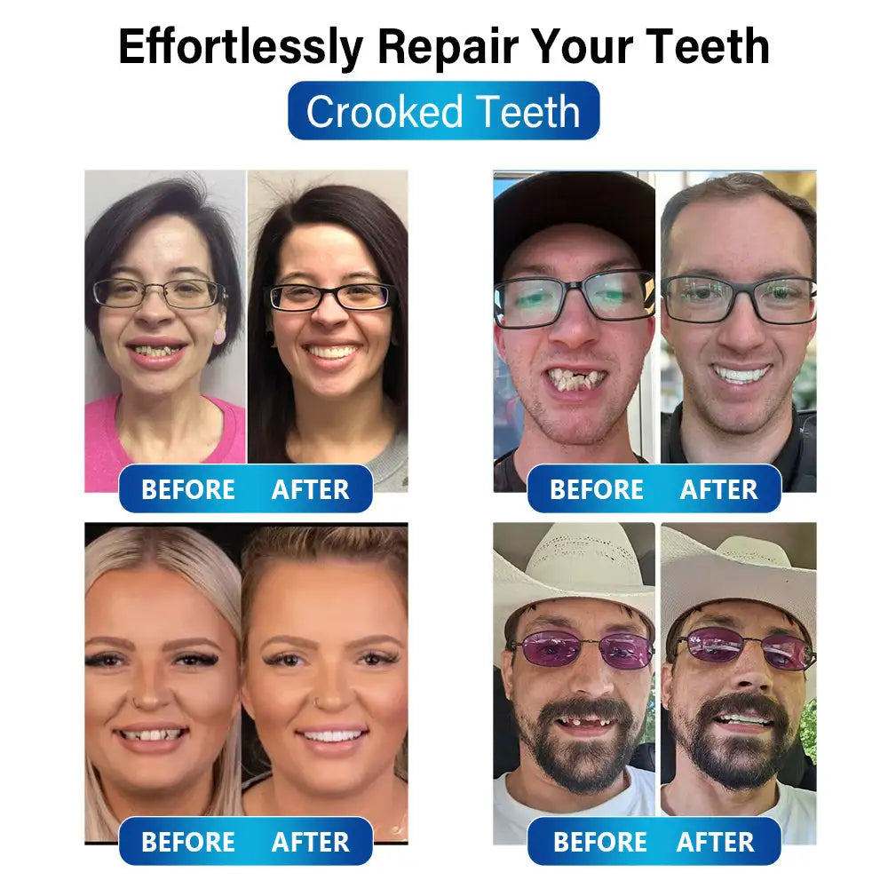 Futusly™ – Professionelle Blaulicht-Härtelampe mit langlebigen Prothesenmaterialien [50 % Rabatt]