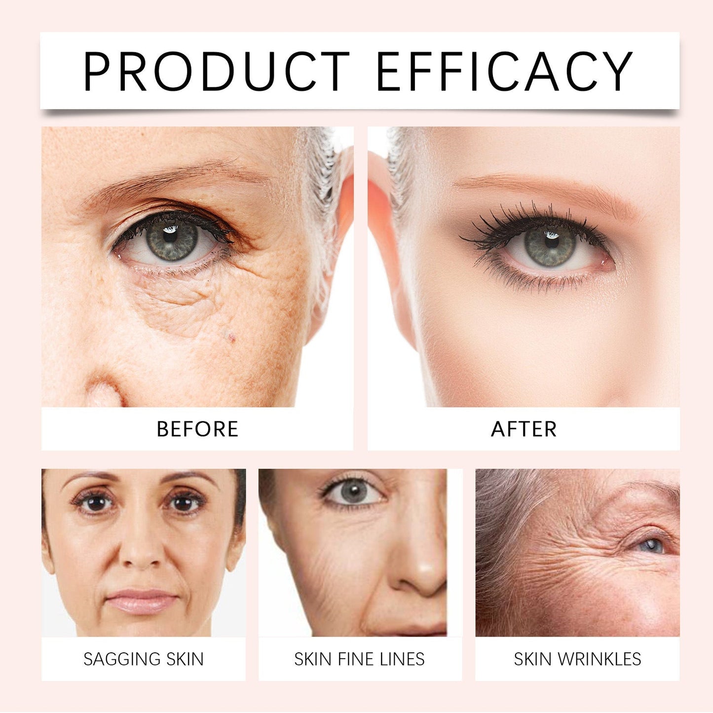 Jorondy™ – Faltenfüller mit Vitamin C für sichtbar glattere, strahlende Haut [50% Rabatt]