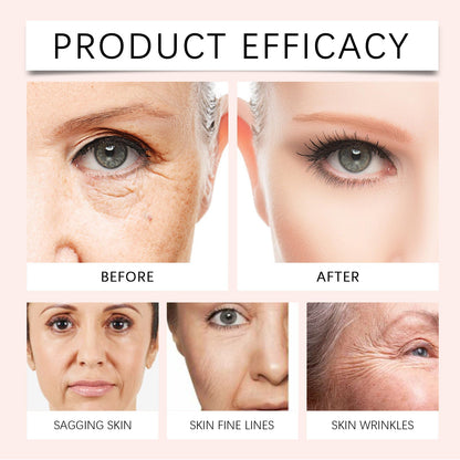 Jorondy™ – Faltenfüller mit Vitamin C für sichtbar glattere, strahlende Haut [50% Rabatt]