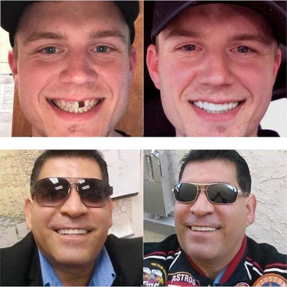 Snap-On™ - Zahnersatz zum Einrasten [50% Rabatt]