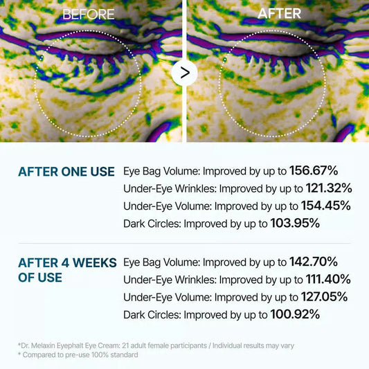 FirmEye™ – Erfrischt müde Augen und enthüllt jugendlich strahlenden Glanz [1 + 1 Gratis]