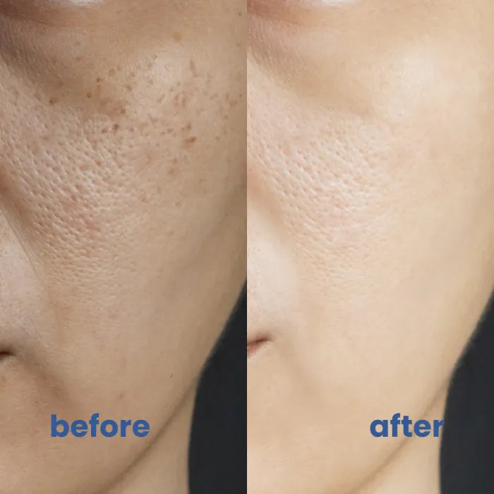 BrightSkin™ – Beruhigende Pflege für perfekte, strahlende Haut [1 + 1 Gratis]