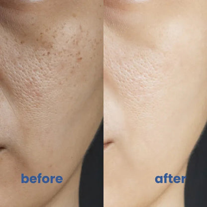 BrightSkin™ – Beruhigende Pflege für perfekte, strahlende Haut [1 + 1 Gratis]