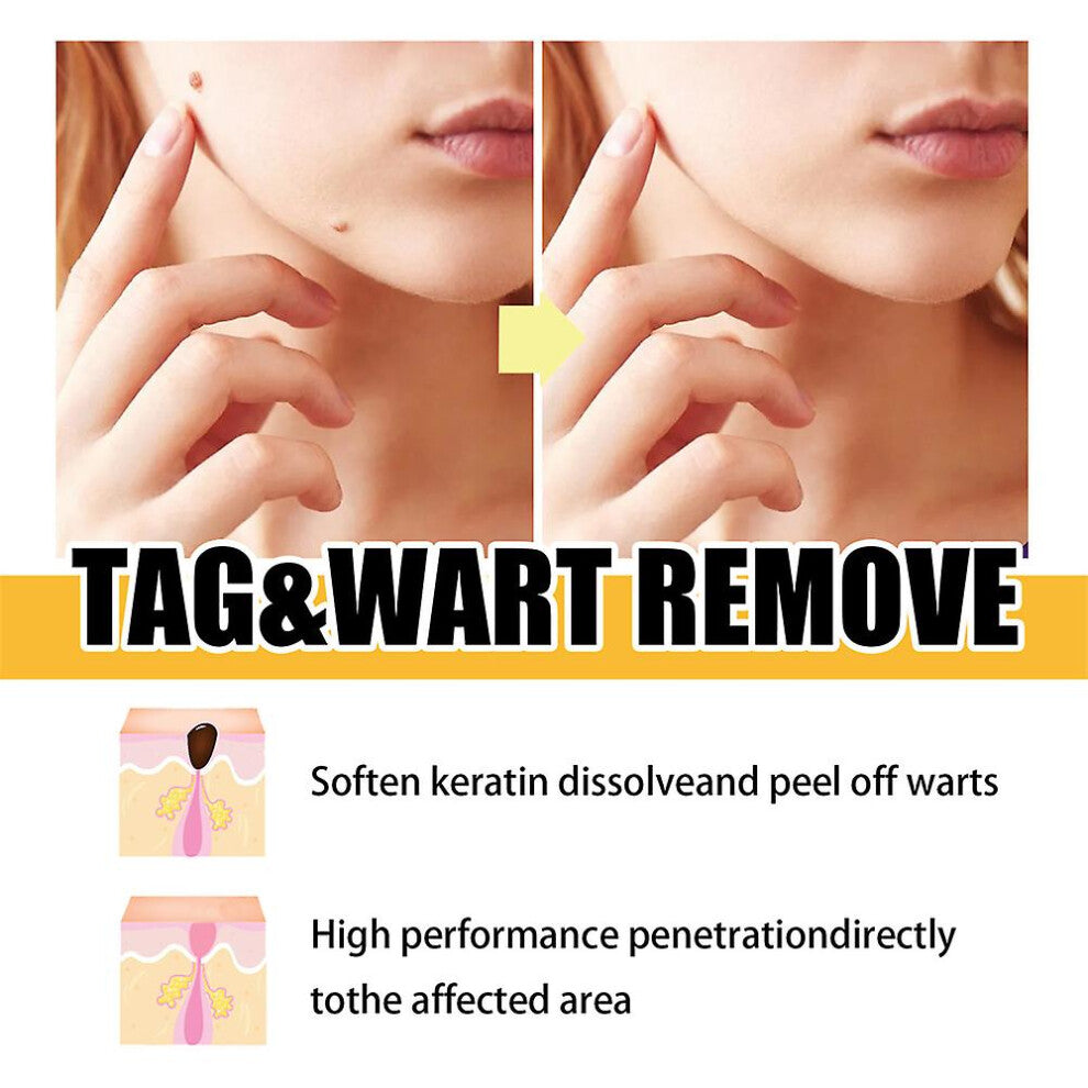 1 + 1 Gratis | BeeVenom™ Schmerzfreie Hauterneuerung [Letzter Tag Rabatt]