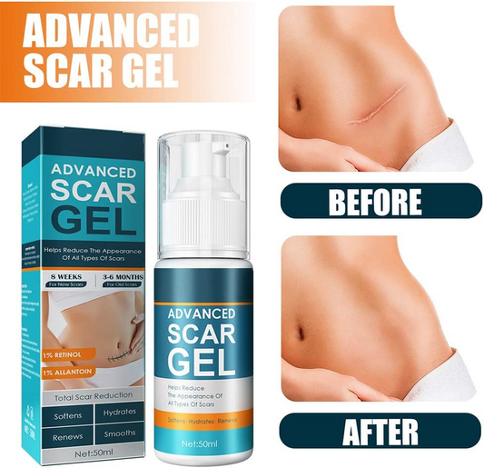 ScarRelief™ – Beruhigt, regeneriert und erneuert die Haut sichtbar sanft [1 + 1 Gratis]