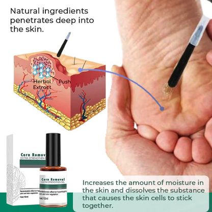 CallusClear™ – Hühneraugen- und Hornhautentferner für sofortige, extra starke Linderung [1 + 1 Gratis]