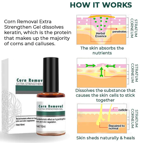CallusClear™ – Effektiver Hühneraugen- & Hornhautentferner mit extra starkem Linderungsgel [1 + 1 Gratis]